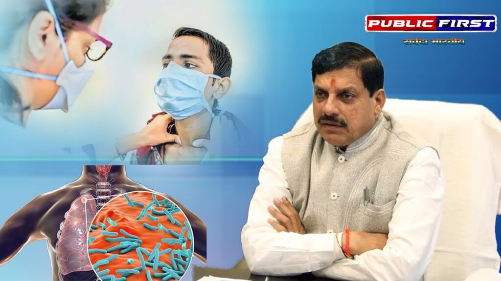 |CM|मप्र को टीबी मुक्त बनाने में जुटी मोहन सरकार, टीबी मुक्त अभियान में शामिल होने की अपील की